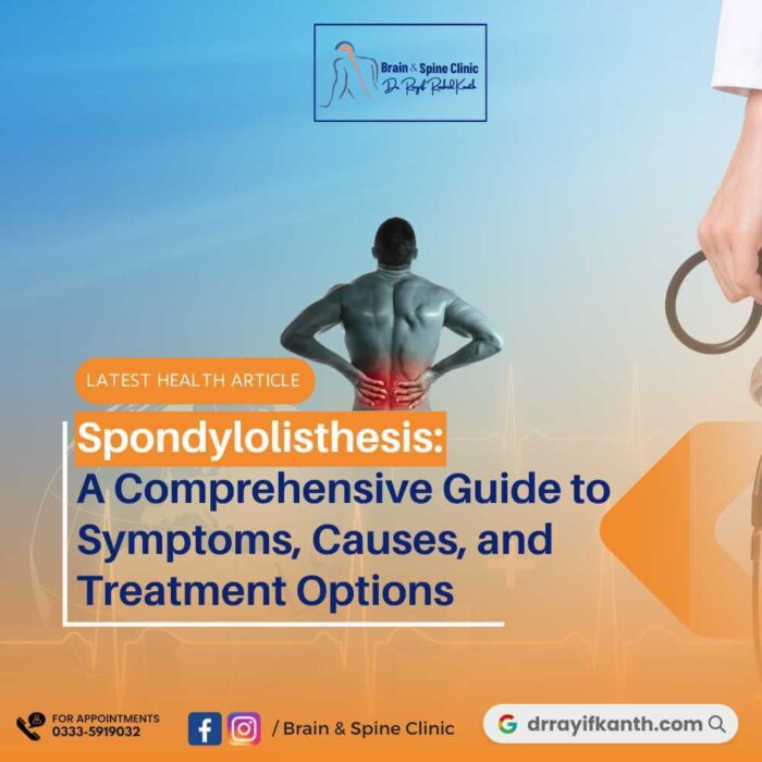 Gain in-depth knowledge about spondylolisthesis, a condition characterized by the slippage of a vertebra, including its symptoms, causes, and various treatment options.